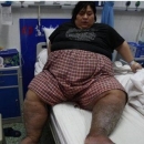 长沙35岁男子体重400多斤危及健康 七种健康减肥方法